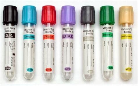 Common blood collection tubes, their additives and laboratory uses - Laboratoryinfo.com