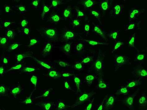 Recombinant Anti-DNase I Antibody, Rabbit Monoclonal, 13801-R006 | Sino ...