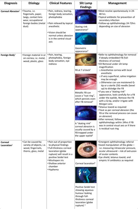 Approach to Corneal Disorders in the ED - CanadiEM