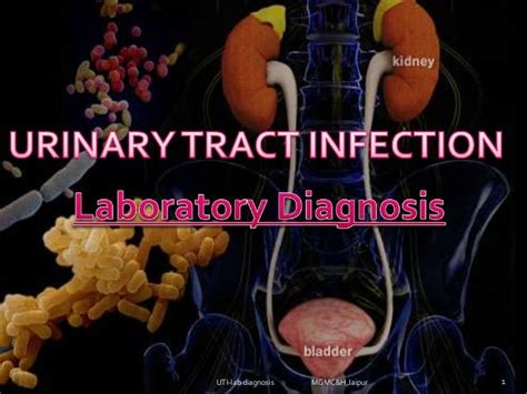 urinary tract infections-Lab diagnosis (e.coli, klebsilla, proteus, p…