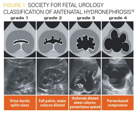 A pediatrician’s dilemma: Understanding, diagnosing, and treating ...