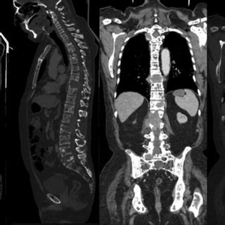 -(A-D) Computed tomography examination of bone structures, from the... | Download Scientific Diagram