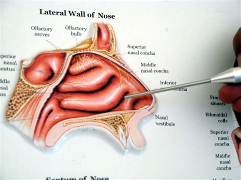 1-nasal turbinates | Nasal blockage, Sinusitis, Nasal obstruction