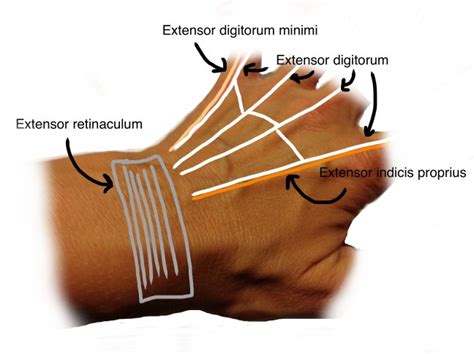 Extensor Tendon Lacerations, Part I – Closing the Gap