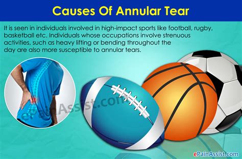 Annular Tear: Treatment, Healing Time, Exercises, Symptoms