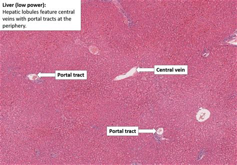 Liver Normal Histology Nus Pathweb | Free Nude Porn Photos