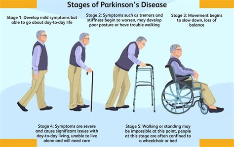 Exploring the 5 Stages of Parkinson's Disease