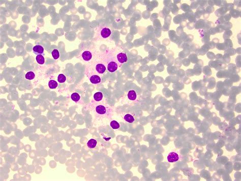 Thyroid Cytology