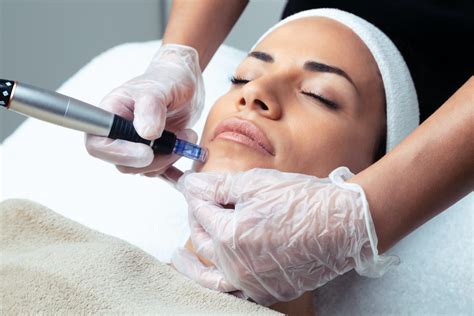 Microneedling At Home: What Does It Do? Best Serums For Microneedling