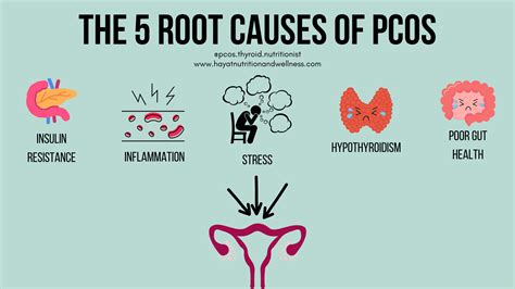 The 5 Root Causes of PCOS | Hayat Nutrition