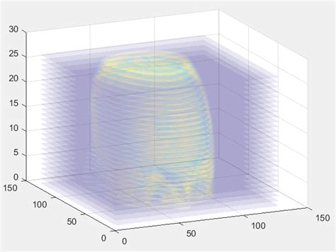 MARE's Computer Vision Study.: slice 2d images to 3d volume plot in matlab