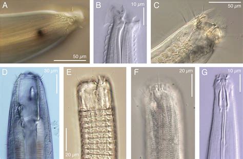 A quick tour of nematode diversity and the backbone of nematode phylogeny