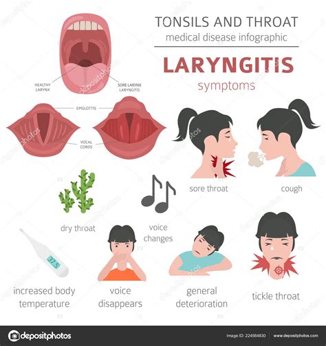 Tonsils Throat Diseases Laryngitis Symptoms Treatment Icon Set Medical Infographic Stock Vector ...