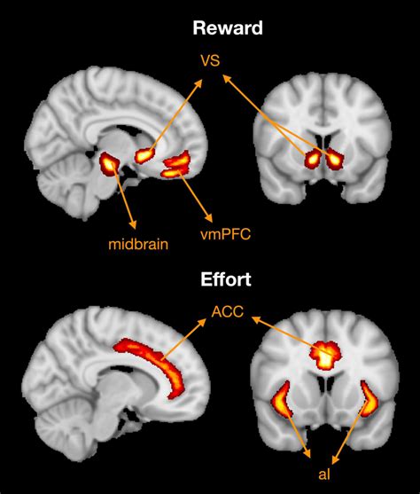 Brain regions associated with reward and effort processing. Based on a... | Download Scientific ...