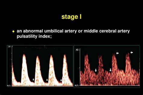 Color doppler in fetal hypoxia