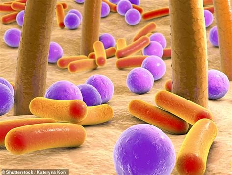 Bacteria that live on EVERYONE'S skin are becoming resistant to ...