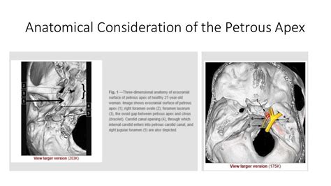 Differential diagnosis in lateral rectus palsy