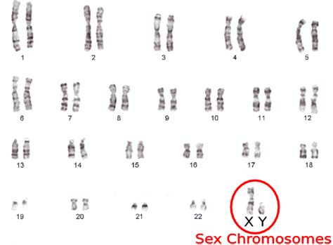 X Chromosome Definition And Disorders | Free Download Nude Photo Gallery