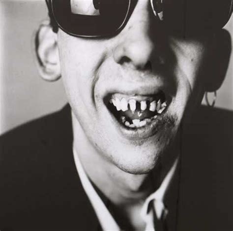 Shane MacGowan (The Pogues) | The pogues, Music history, Famous faces