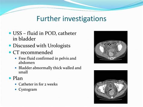 PPT - Ketamine Bladder PowerPoint Presentation, free download - ID:3797846