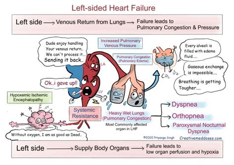 Heart Failure: Left sided VS Right sided - Creative Med Doses