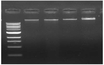 Blood DNA Extraction Kit, Magnetic Bead Purification Kit/Solutions, Isolation | G2M