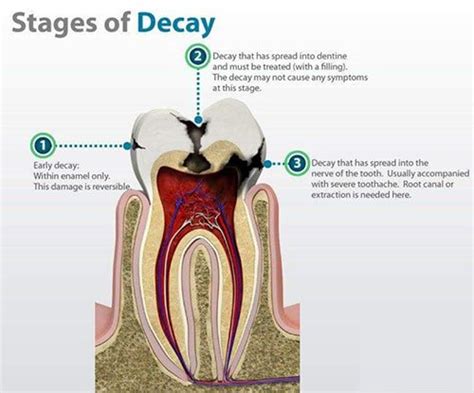 Restorative Dentistry - Century Smile | Culver City Dentist