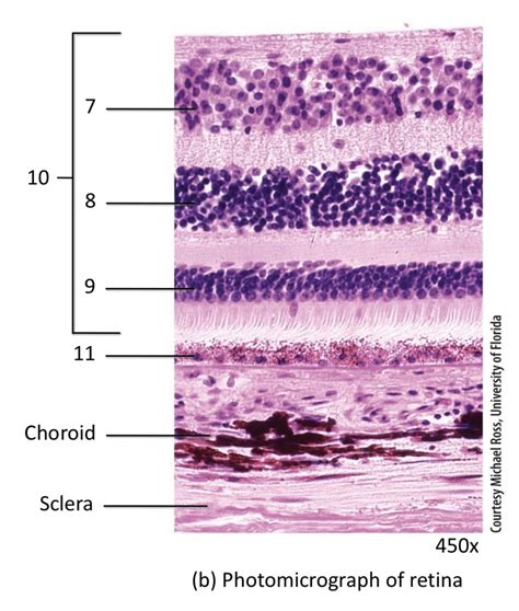 micrograph of retina diagram Diagram | Quizlet