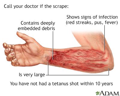 Scrape Information | Mount Sinai - New York