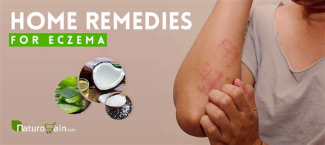 Eczema Skin Rashes Treatment