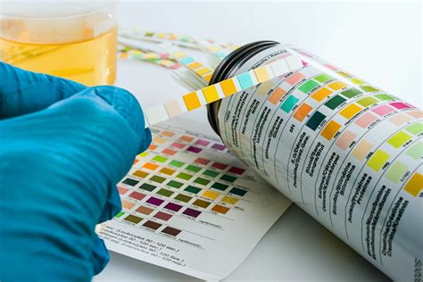 Protein in the Urine: Causes and Treatment | Chronic Kidney Disease 101