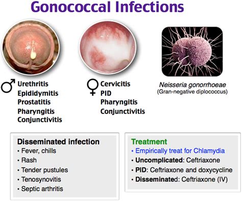 Gonococcal Infections Rosh Review (With images) | Pharmacology ...