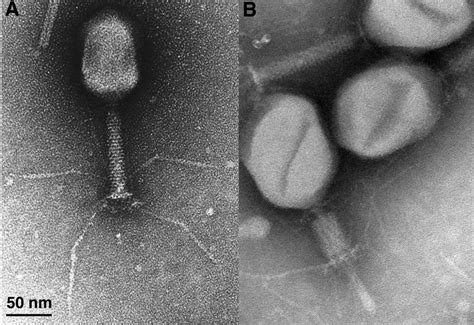 Electron micrograph of Bacteriophage | Electron microscope, Scanning electron micrograph ...