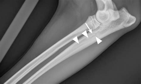 Complete Guide to Panosteitis in Dogs | Clinician's Brief