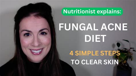 Fungal Acne Diet: What to Eat & What to Avoid | NUTRITIONIST EXPLAINS ...