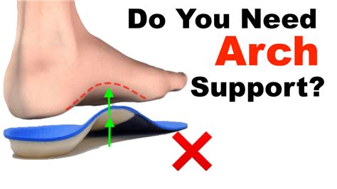 Should You Wear Arch Support? (The TRUTH Behind Orthotics) – Squat University