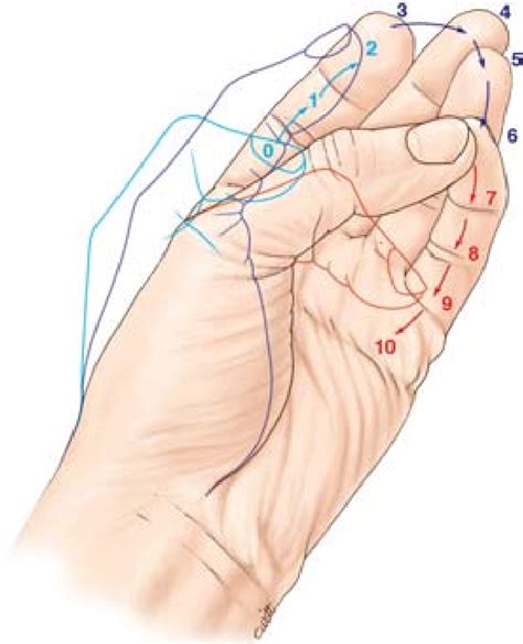 Figure 2.22 from Trapeziometacarpal Joint Arthritis | Semantic Scholar