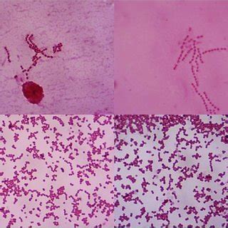 Microscopic images of Streptococcus dysglactiae subsp. equisimilis... | Download Scientific Diagram