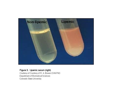 HEALTH FROM TRUSTED SOURCES: High Triglycerides (Hypertriglyceridemia)