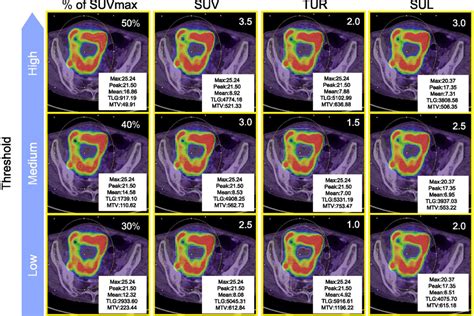 Thresholds in case of a higher SUVmax tumor. SUVmax, maximal... | Download Scientific Diagram