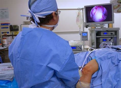 Arthroscopic Knee Surgery Complications