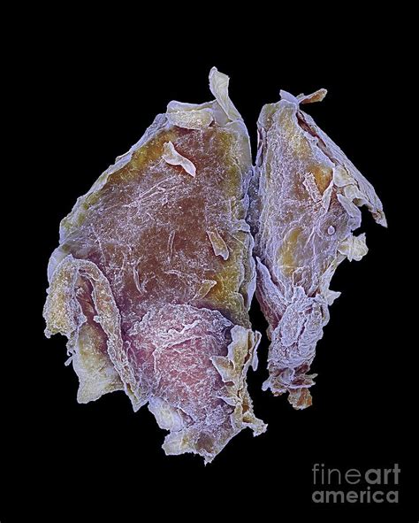 Dead Skin Photograph by Dennis Kunkel Microscopy/science Photo Library - Pixels