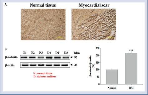 Figure 1 from Enhancement of beta-catenin in cardiomyocytes suppresses ...