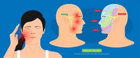 Trigeminal Nerve Examination