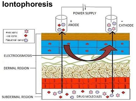 Iontophoresis treatment, physical therapy, medication & side effects