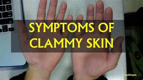 SYMPTOMS OF CLAMMY SKIN - YouTube