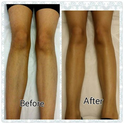 Leg Waxing Before And After