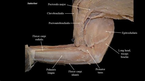 Cat musculature | Atlas of Comparative Vertebrate Anatomy