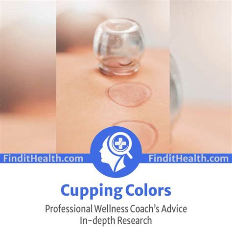 Cupping Colors (Marks Chart) — (Health Coach’s Advice)