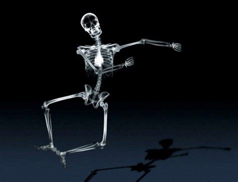 funny-skeleton-dancing | Xray art, Skeleton dance, Funny skeleton